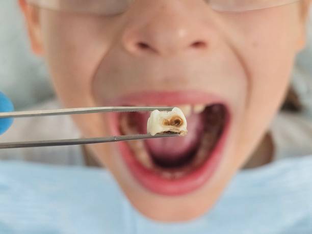 Best Emergency Treatment for Oral Infections in Mion, AR
